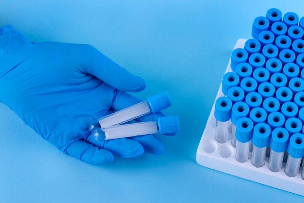 Analiza przypadków firm, które odniosły sukces w przetargach medycznych, może dostarczyć cennych wskazówek dotyczących efektywnych strategii i błędów do uniknięcia